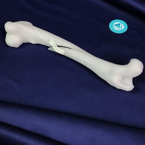 Femur 05 5