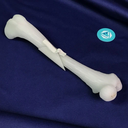 Femur 04 3