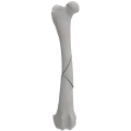 Femur 04 1