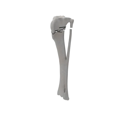 renderowanie kosci.488
