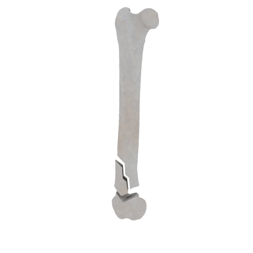 11-a2.532.png