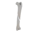 11-a2.478.png