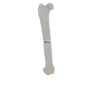 11-a2.482.png