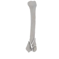 11-a2.285.png