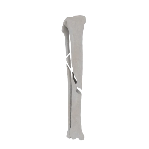 11-a2.613.png